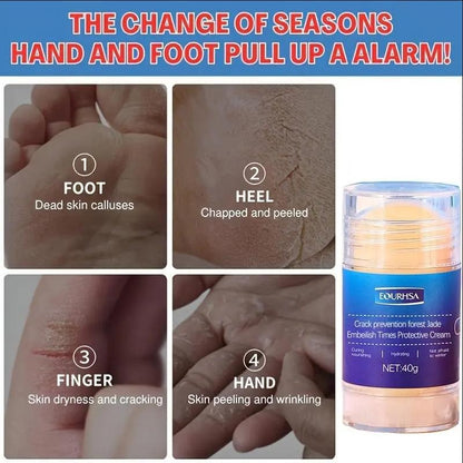 【Buy 1 Get 1】Anti Crack Foot Care Cream