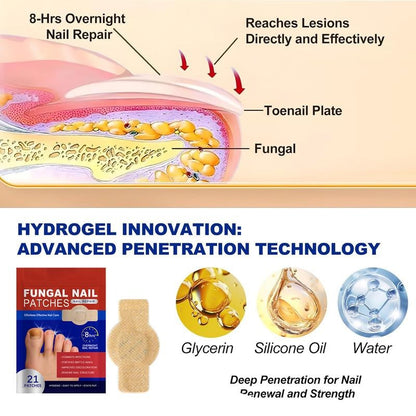 Fungal Nail Patches